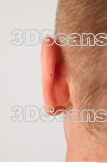 Ear texture of Gene 0001